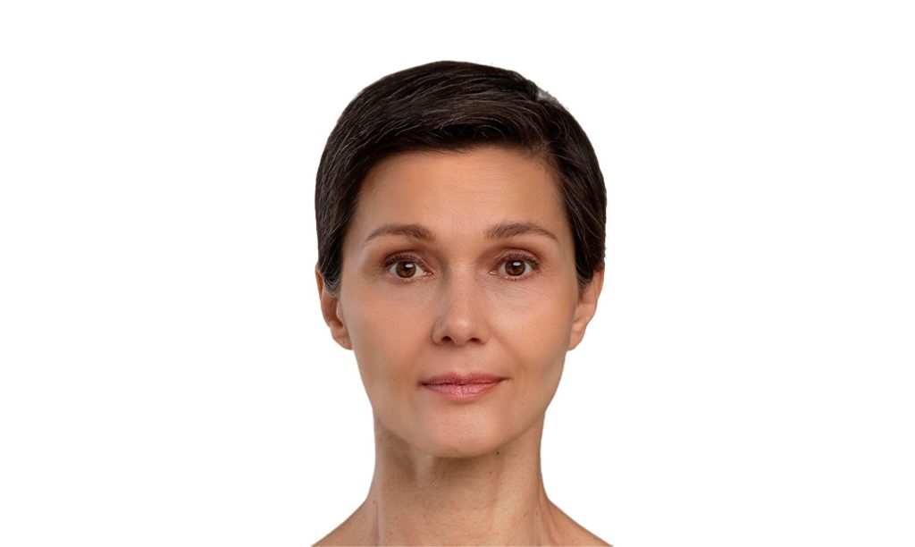 Après