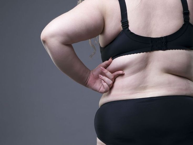 Chirurgie de l'obésité en Tunisie : sleeve, bypass, que choisir ?